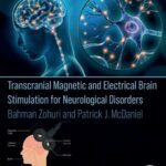 خرید و دانلود نسخه کامل کتاب Transcranial Magnetic and Electrical Brain Stimulation for Neurological Disorders
