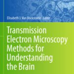 خرید و دانلود نسخه کامل کتاب Transmission Electron Microscopy Methods for Understanding the Brain