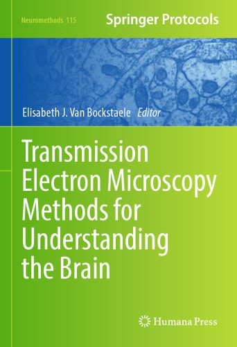 خرید و دانلود نسخه کامل کتاب Transmission Electron Microscopy Methods for Understanding the Brain_68bb242cb7f48.jpeg خرید و دانلود نسخه کامل کتاب Transmission Electron Microscopy Methods for Understanding the Brain