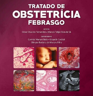 خرید و دانلود نسخه کامل کتاب Tratado de obstetrícia Febrasgo