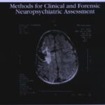 خرید و دانلود نسخه کامل کتاب TRAUMATIC BRAIN INJURY Methods for Clinical and Forensic Neuropsychiatric Assessment