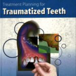 خرید و دانلود نسخه کامل کتاب Treatment Planning for Traumatized Teeth
