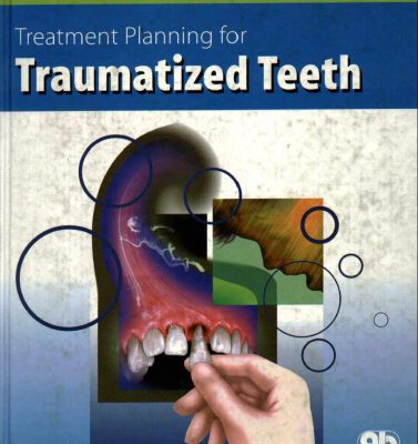 خرید و دانلود نسخه کامل کتاب Treatment Planning for Traumatized Teeth