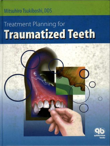 خرید و دانلود نسخه کامل کتاب Treatment Planning for Traumatized Teeth_68b85916b65ac.jpeg خرید و دانلود نسخه کامل کتاب Treatment Planning for Traumatized Teeth