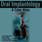 خرید و دانلود نسخه کامل کتاب Treatment Planning Steps in Oral Implantology: A Color Atlas