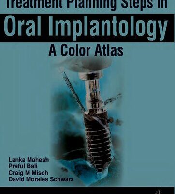 خرید و دانلود نسخه کامل کتاب Treatment Planning Steps in Oral Implantology: A Color Atlas