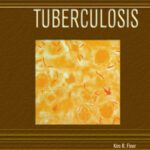 خرید و دانلود نسخه کامل کتاب Tuberculosis (Deadly Diseases and Epidemics)