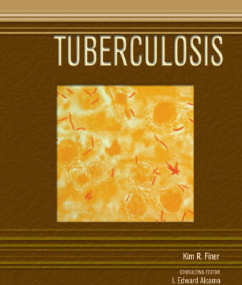 خرید و دانلود نسخه کامل کتاب Tuberculosis (Deadly Diseases and Epidemics)