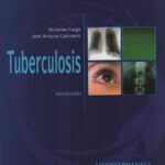 خرید و دانلود نسخه کامل کتاب Tuberculosis