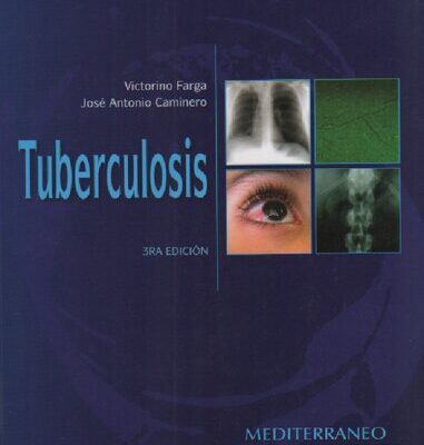 خرید و دانلود نسخه کامل کتاب Tuberculosis