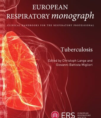 خرید و دانلود نسخه کامل کتاب Tuberculosis