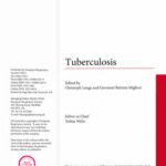 خرید و دانلود نسخه کامل کتاب Tuberculosis