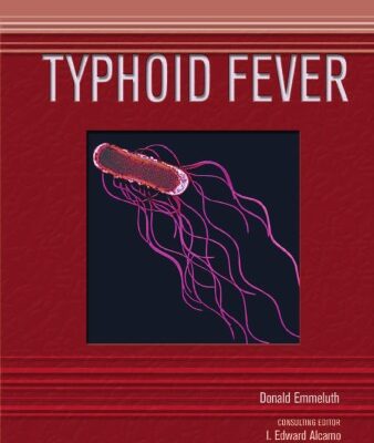 خرید و دانلود نسخه کامل کتاب Typhoid Fever (Deadly Diseases and Epidemics)