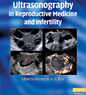 خرید و دانلود نسخه کامل کتاب Ultrasonography in Reproductive Medicine and Infertility
