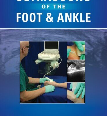 خرید و دانلود نسخه کامل کتاب Ultrasound of The Foot and Ankle