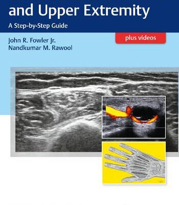 خرید و دانلود نسخه کامل کتاب Ultrasound of the Hand and Upper Extremity: A Step-by-Step Guide