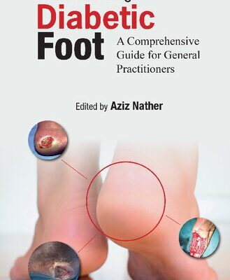 خرید و دانلود نسخه کامل کتاب Understanding Diabetic Foot: A Comprehensive Guide For General Practitioners
