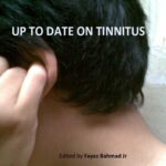 خرید و دانلود نسخه کامل کتاب Up to Date on Tinnitus