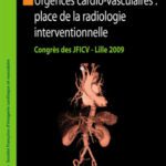 خرید و دانلود نسخه کامل کتاب Urgences cardio-vasculaires : place de la radiologie interventionnelle: Congrès des JFICV Lille 2009 (Collection de la Société française dimagerie cardiaque et vasculaire) (French Edition)