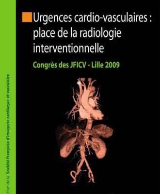 خرید و دانلود نسخه کامل کتاب Urgences cardio-vasculaires : place de la radiologie interventionnelle: Congrès des JFICV Lille 2009 (Collection de la Société française dimagerie cardiaque et vasculaire) (French Edition)