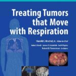 خرید و دانلود نسخه کامل کتاب Urschel Treating Tumors That Move With Respiration