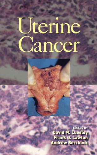 خرید و دانلود نسخه کامل کتاب Uterine Cancer_68bb27789558f.jpeg خرید و دانلود نسخه کامل کتاب Uterine Cancer