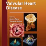 خرید و دانلود نسخه کامل کتاب Valvular Heart Disease