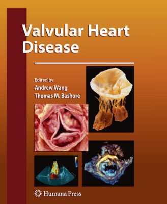 خرید و دانلود نسخه کامل کتاب Valvular Heart Disease