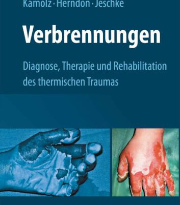 خرید و دانلود نسخه کامل کتاب Verbrennungen: Diagnose, Therapie und Rehabilitation des thermischen Traumas