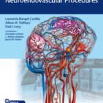 خرید و دانلود نسخه کامل کتاب Video Atlas of Neuroendovascular Procedures