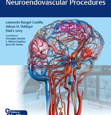 خرید و دانلود نسخه کامل کتاب Video Atlas of Neuroendovascular Procedures