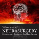 خرید و دانلود نسخه کامل کتاب Video Atlas of Neurosurgery: Contemporary Tumor and Skull Base Surgery