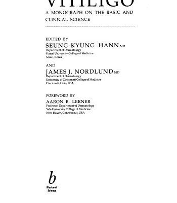 خرید و دانلود نسخه کامل کتاب Vitiligo: A Monograph on the Basic and Clinical Science