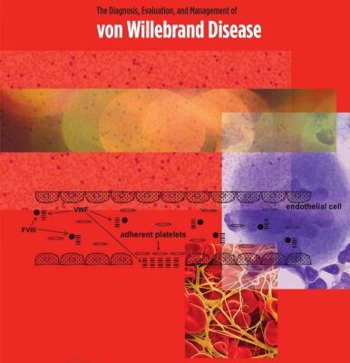 خرید و دانلود نسخه کامل کتاب von Willebrand Disease