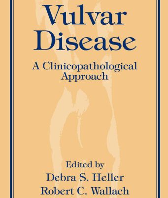 خرید و دانلود نسخه کامل کتاب Vulvar Disease – A Clinicopathological Approach