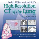 خرید و دانلود نسخه کامل کتاب Webb, Müller and Naidich’s High-Resolution CT of the Lung