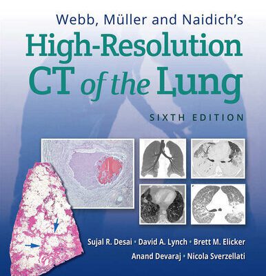 خرید و دانلود نسخه کامل کتاب Webb, Müller and Naidich’s High-Resolution CT of the Lung