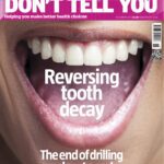 خرید و دانلود نسخه کامل کتاب What Doctors Dont Tell You – Reversing tooth decay, the end of drilling and root canals