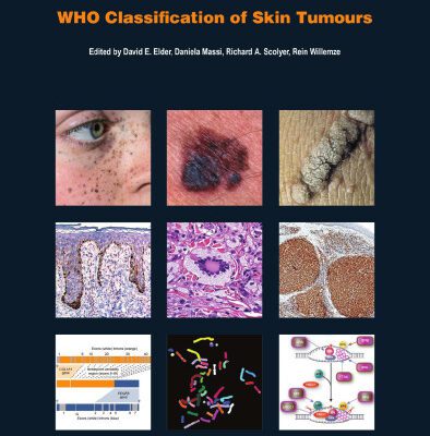 خرید و دانلود نسخه کامل کتاب WHO Classification of Skin Tumours