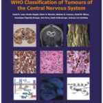 خرید و دانلود نسخه کامل کتاب WHO Classification of Tumours of the Central Nervous System