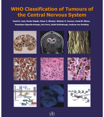 خرید و دانلود نسخه کامل کتاب WHO Classification of Tumours of the Central Nervous System