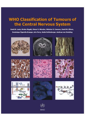خرید و دانلود نسخه کامل کتاب WHO Classification of Tumours of the Central Nervous System_68bb264ca6e6c.jpeg خرید و دانلود نسخه کامل کتاب WHO Classification of Tumours of the Central Nervous System