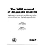 خرید و دانلود نسخه کامل کتاب Who Manual for Diagnostic Imaging Radiographic Anatomy And Interpretation of the Chest And the Pulmonary System