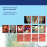 خرید و دانلود نسخه کامل کتاب Zahn-Mund-Kiefer-Heilkunde: Mund-Kiefer-Gesichtschirurgie