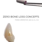 خرید و دانلود نسخه کامل کتاب Zero Bone Loss Concepts