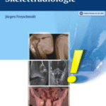 خرید و دانلود نسخه کامل کتاب Zufallsbefunde in der Skelettradiologi – Original PDF