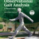 خرید و دانلود نسخه کامل کتاب Observational Gait Analysis: A Visual Guide 1st Edition + Pdf