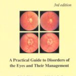 خرید و دانلود نسخه کامل کتاب A Textbook of Clinical Ophthalmology: A Practical Guide to Disorders of the Eyes and Their Management