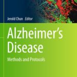 خرید و دانلود نسخه کامل کتاب Alzheimer’s Disease: Methods and Protocols