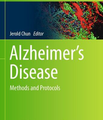 خرید و دانلود نسخه کامل کتاب Alzheimer’s Disease: Methods and Protocols